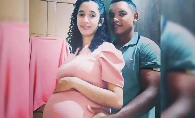 Filhas acreanos, gêmeas siamesas que compartilham o mesmo coração nascem em Brasília