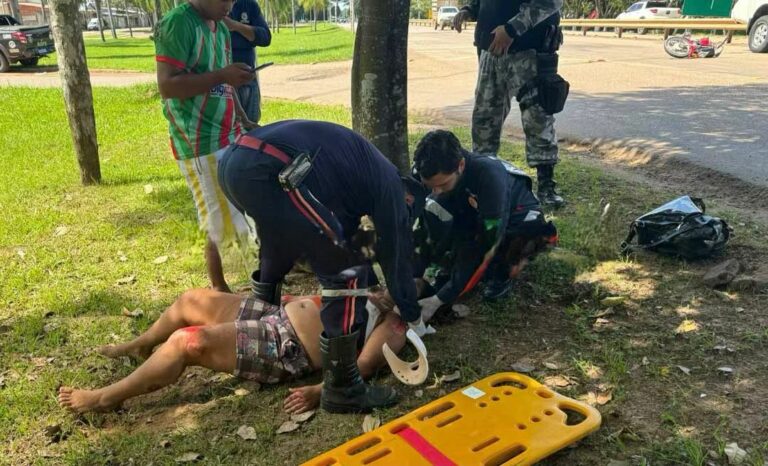 Mulher fica gravemente ferida após camionete tentar desviar de buracos e bater em moto