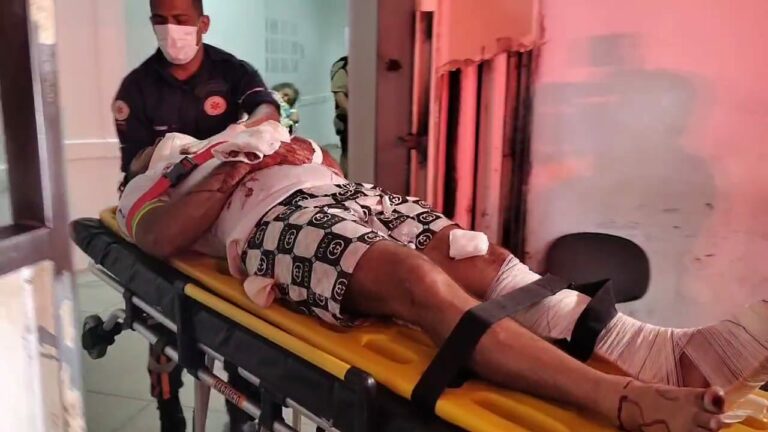 Idoso e homem de 34 anos ficam gravemente feridos durante acidente na Sobral