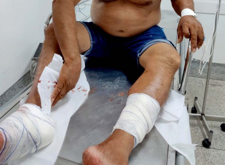 Homem é baleado por faccionados após se recusar a entrar em facção ou ceder casa em Brasiléia