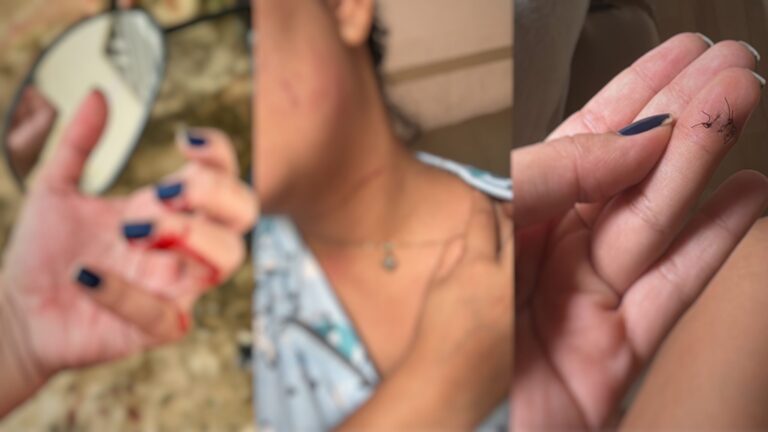 Após empresária ser ferida com linha, vereadores no Acre aprovam lei que proíbe cerol em pipas