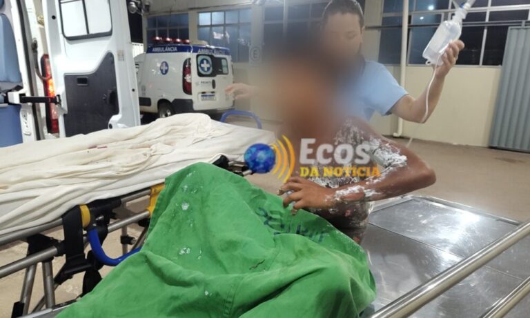 Criança indígena sofre descarga elétrica ao tocar fio de alta tensão em Boca do Acre