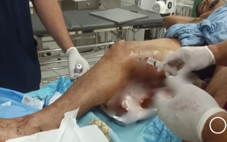 Agricultor é baleado ao cair em armadilha montada pelo próprio irmão