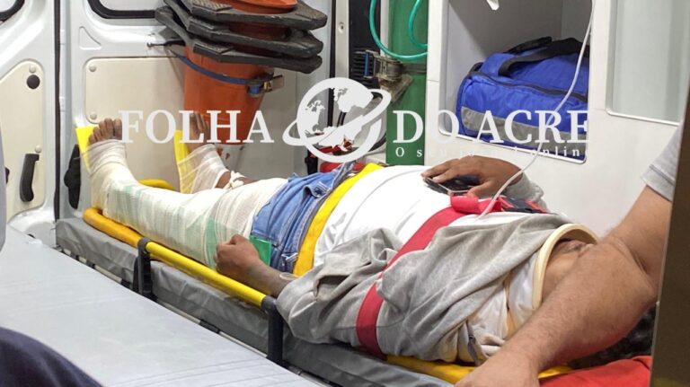 Motociclista de aplicativo tem as duas pernas quebradas após condutor de veículo furar sinal vermelho no centro de Rio Branco