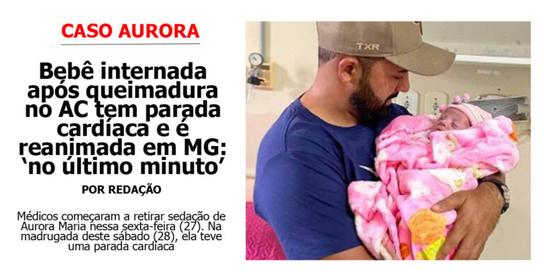 Bebê internada após queimadura tem parada cardíaca e é reanimada em MG: ‘no último minuto’