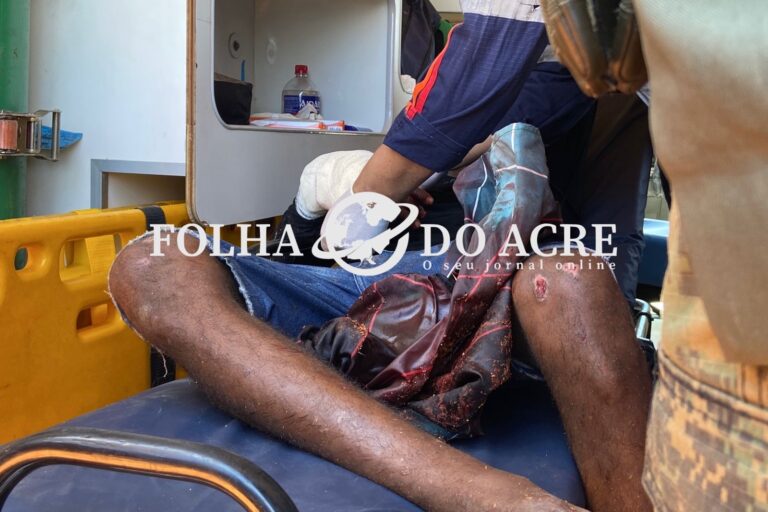 Homem é baleado na mão como forma de disciplina por membros de facção ao visitar namorada na Cidade do Povo