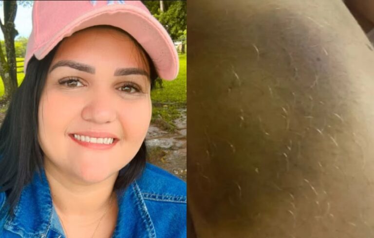 Morte de enfermeira em UPA no Acre expõe suposto histórico de violência doméstica