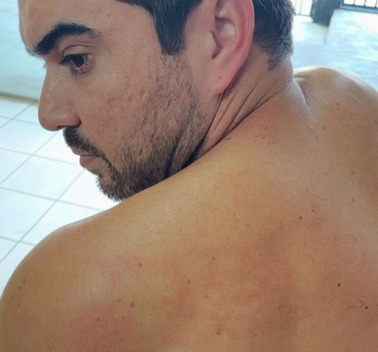Vereador registra ocorrência contra colega por suposta agressão na Câmara de Senador Guiomard após críticas ao governador