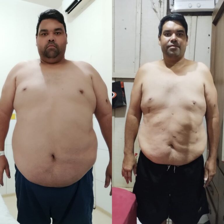 Uma nova vida: como a cirurgia bariátrica transformou a rotina e a saúde de pacientes pelo Programa de Obesidade