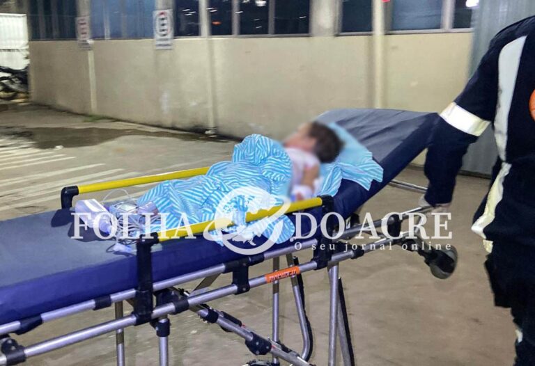 Bebê de 1 ano sofre queimaduras graves após acidente doméstico em Rio Branco