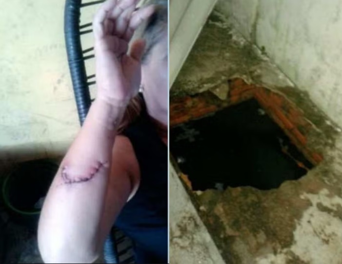 Mulher que caiu em fossa em hospital no Acre é indenizada em R$ 14 mil